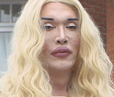 Pete Burns
