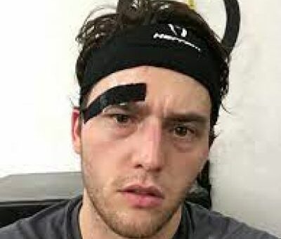 Nick Sachvie