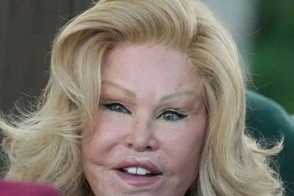 Jocelyn Wildenstein