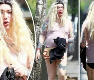 Pete Burns