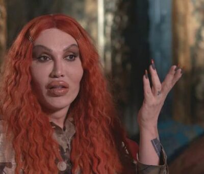 Pete Burns