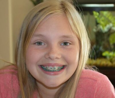 Braces Girl